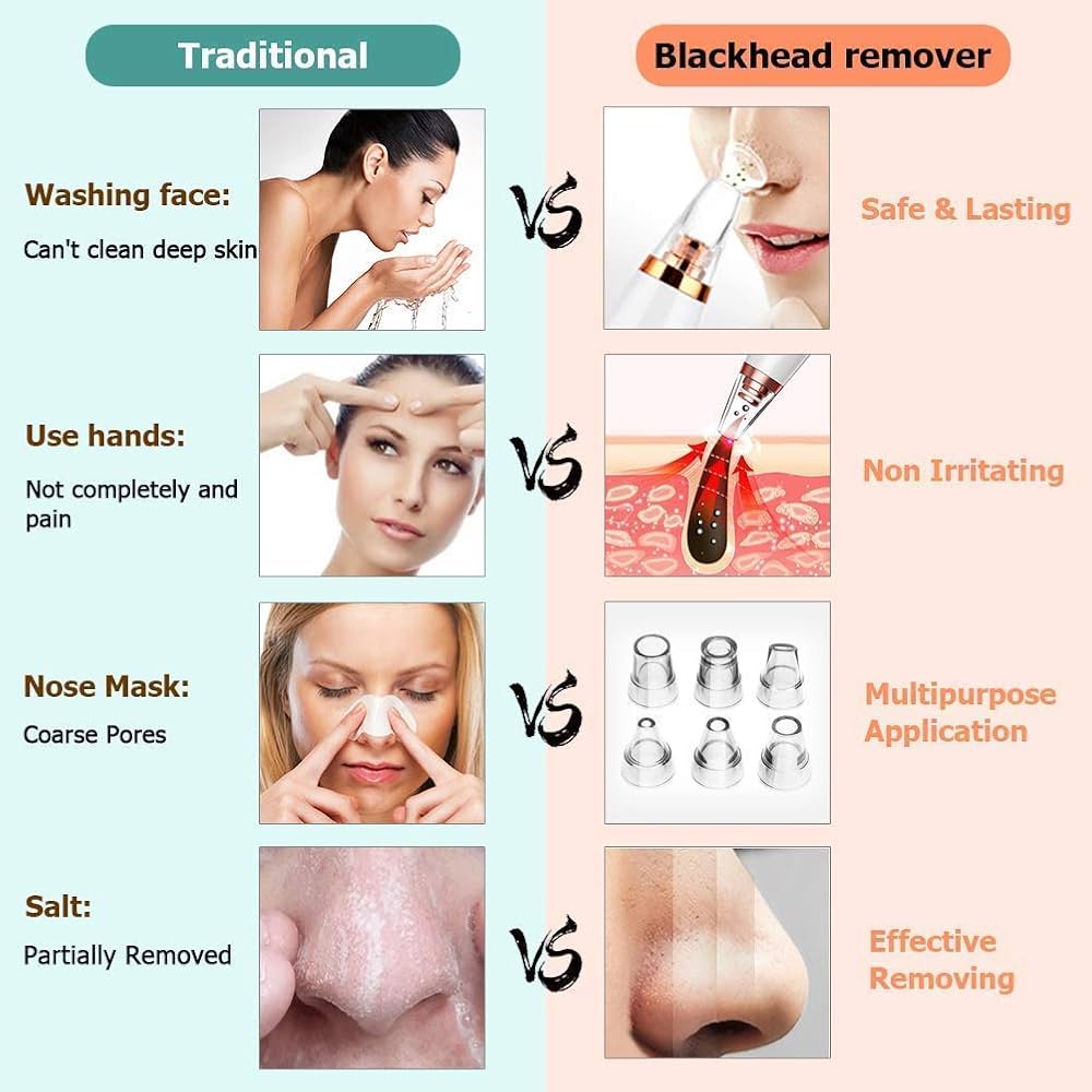 Blackhead Remover Vacuum – Deep Pore Cleaner