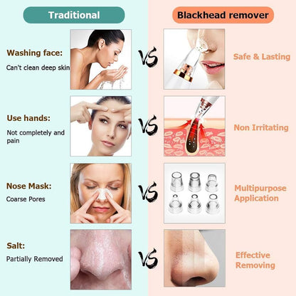 Blackhead Remover Vacuum – Deep Pore Cleaner