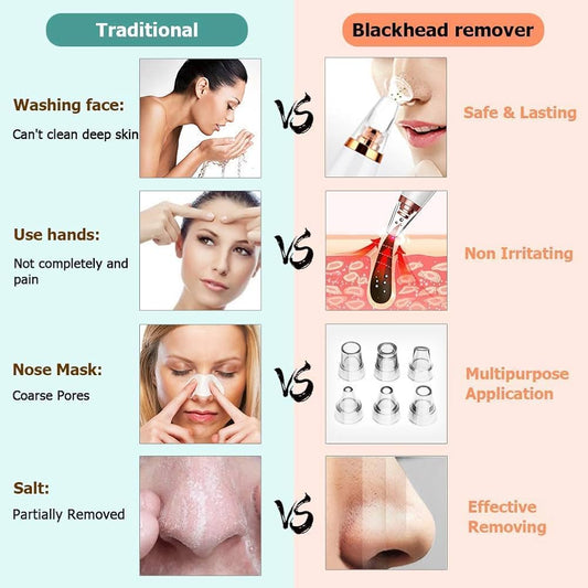 Blackhead Remover Vacuum – Deep Pore Cleaner