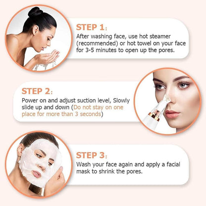 Blackhead Remover Vacuum – Deep Pore Cleaner