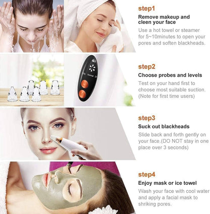 Blackhead Remover Vacuum – Deep Pore Cleaner